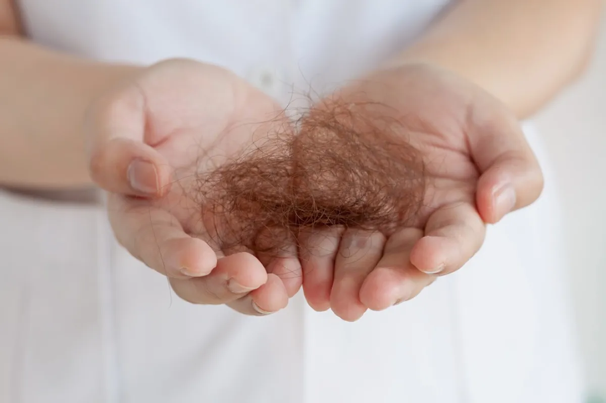 صورة لامرأة تعاني من تساقط الشعر