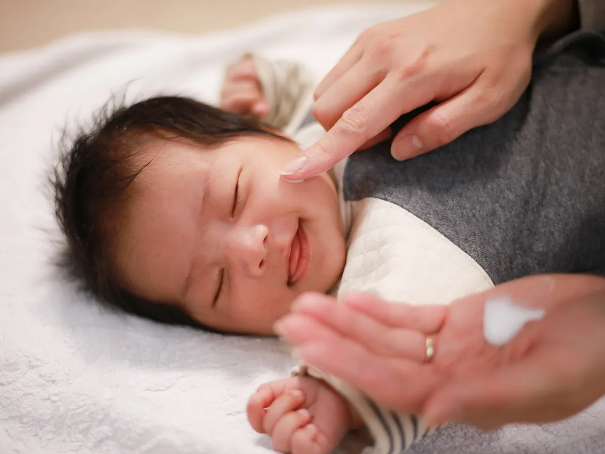 أسباب ظهور النمشات الدموية عند الأطفال الرضع