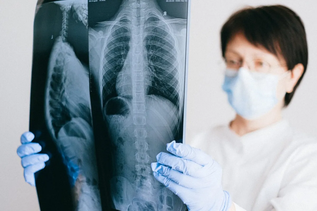 أعراض جلطة الرئة