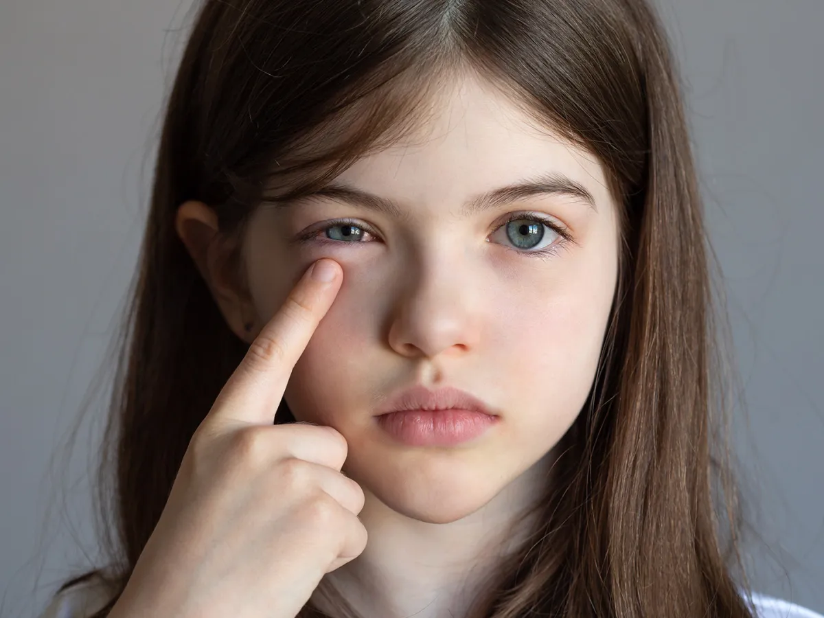 الوقاية من التهابات العين عند الأطفال