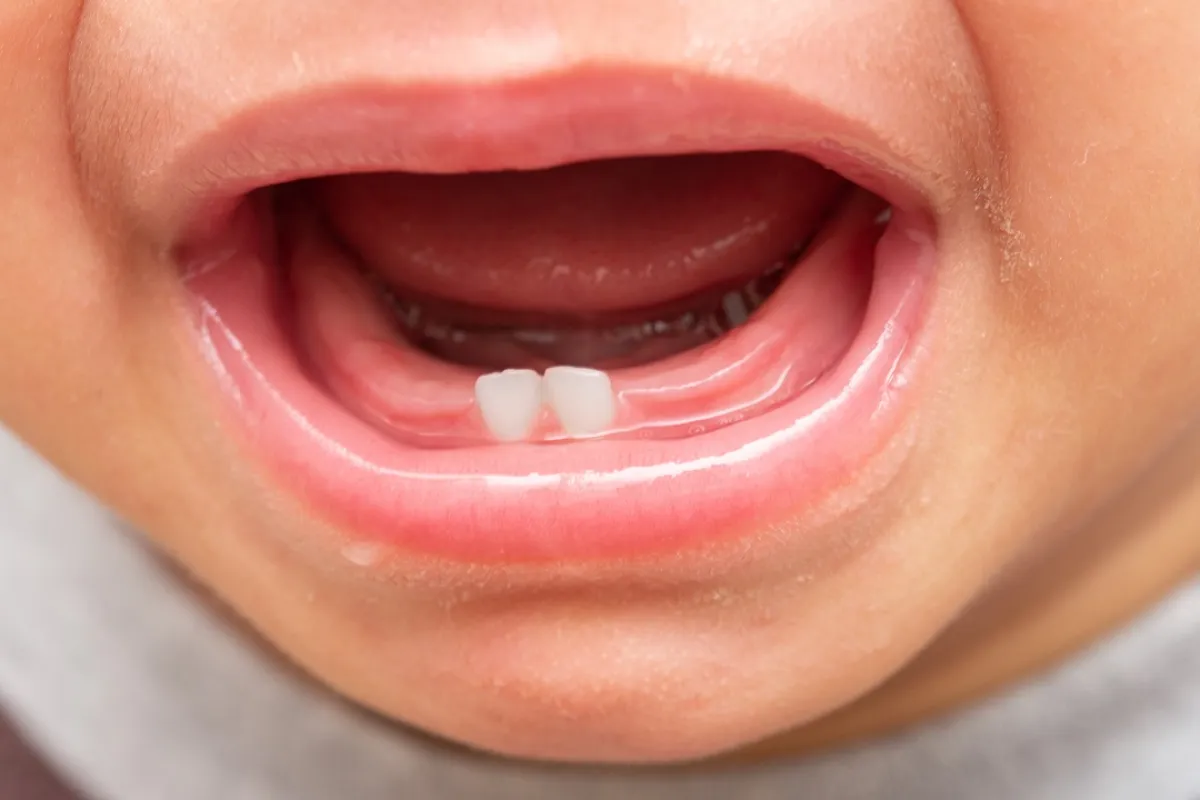 صورة لأسنان طفل