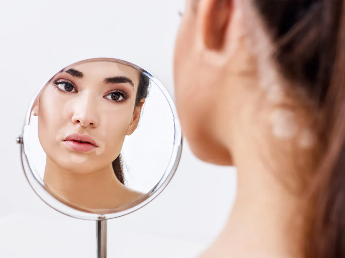 تفسير حلم البهاق 