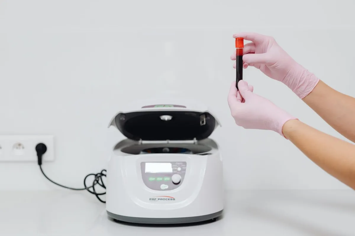 علاج الثلاسيميا بالخلايا الجذعية