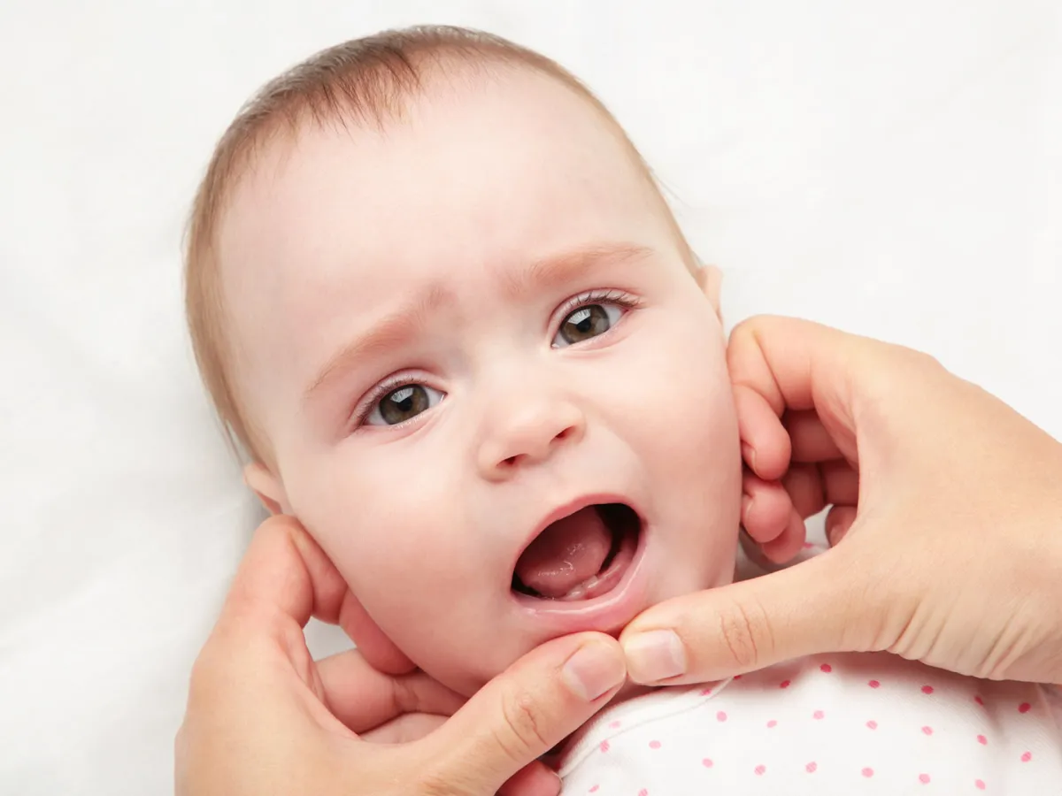 متى يمكن القلق على تأخر طفلك في التسنين والعمر المناسب للتسنين الطبيعي؟