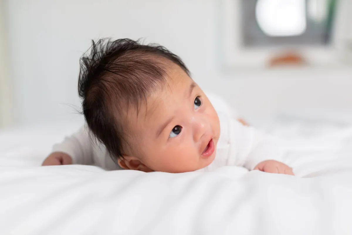 صورة لرضيع لديه تساقط في مقدمة رأسه