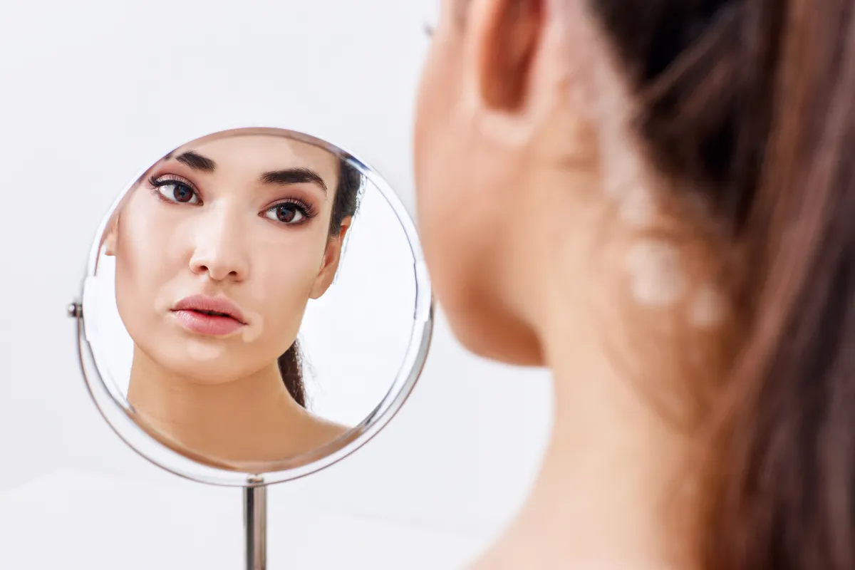 البهاق يختلف عن نقص التصبُّغ