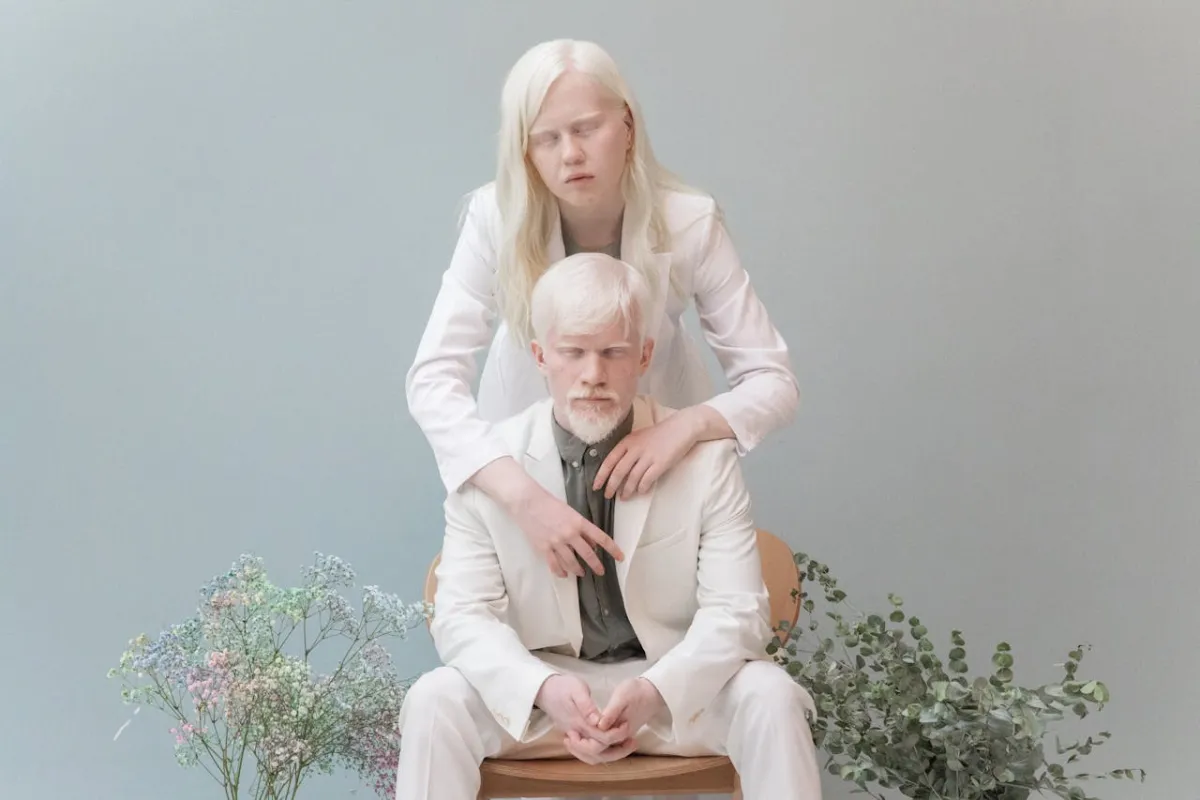 مصابان بمرض المهق