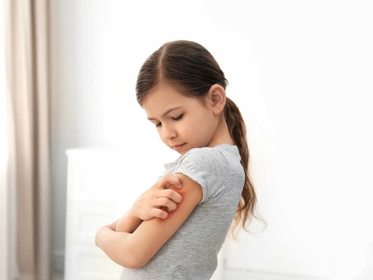 أعراض وأسباب الحساسية الغذائية عند الأطفال.. وأفضل طرق التعامل معها