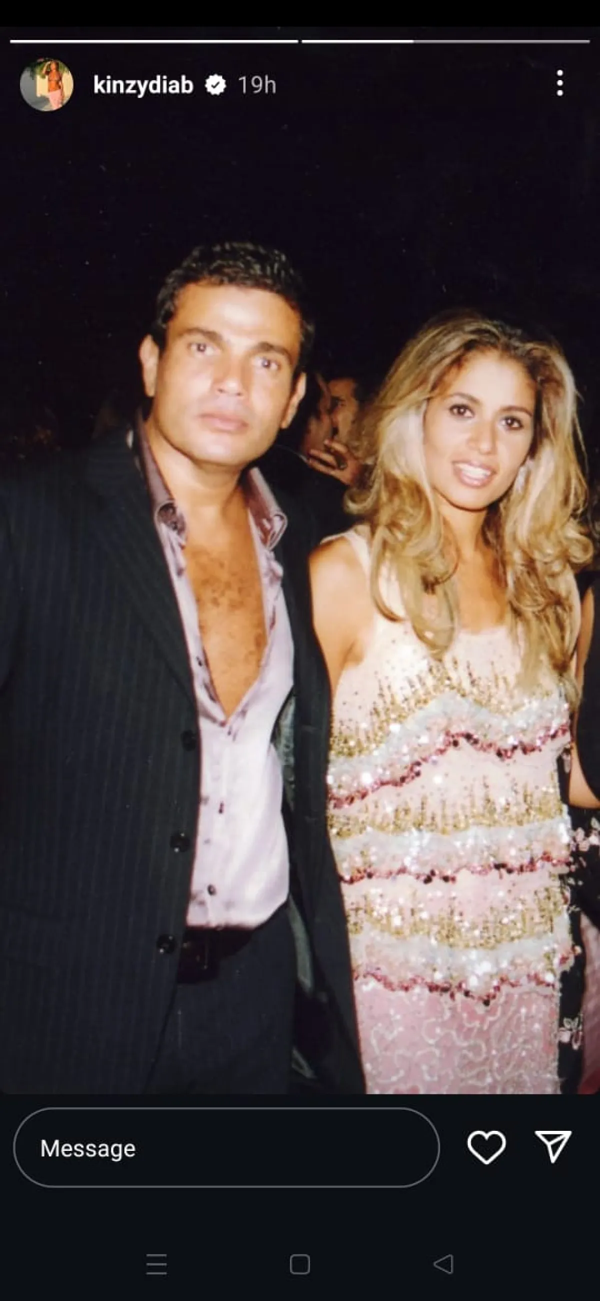 عمرو دياب وطليقته زينة عاشور- الصورة من خاصية القصص القصيرة بحساب كنزي عمرو دياب على إنستغرام