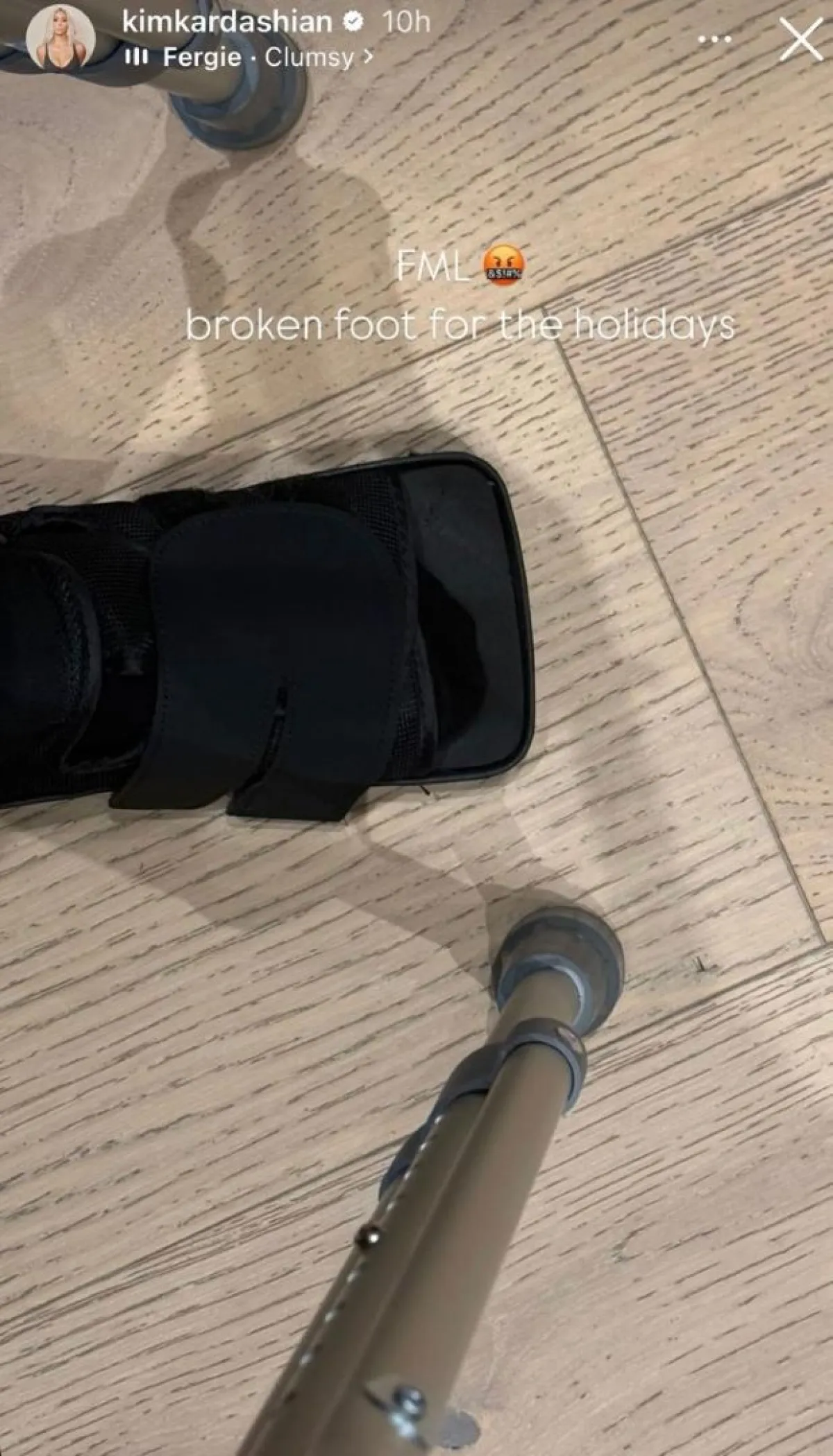 كيم كارداشيان تكشف كسر قدمها- الصورة من قصص حسابها الخاص بإنستغرام