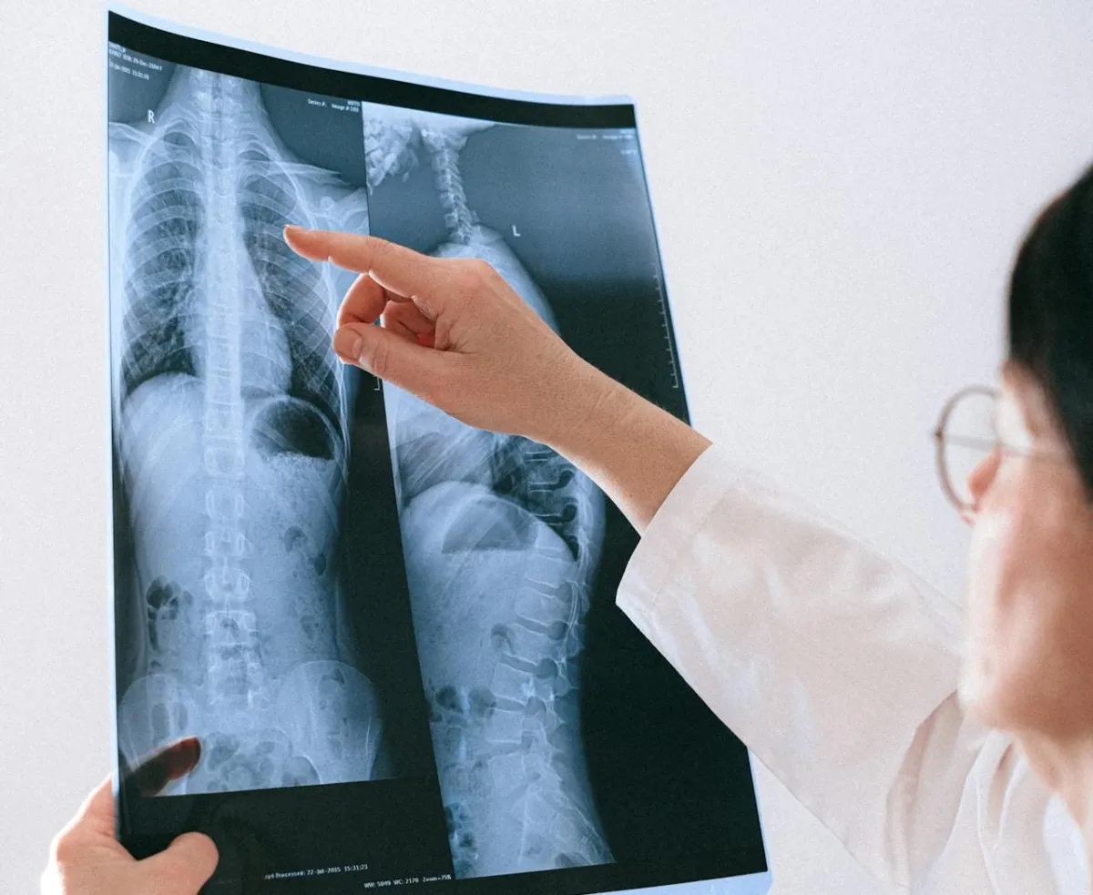 طبيبة تنظر إلى صورة أشعة