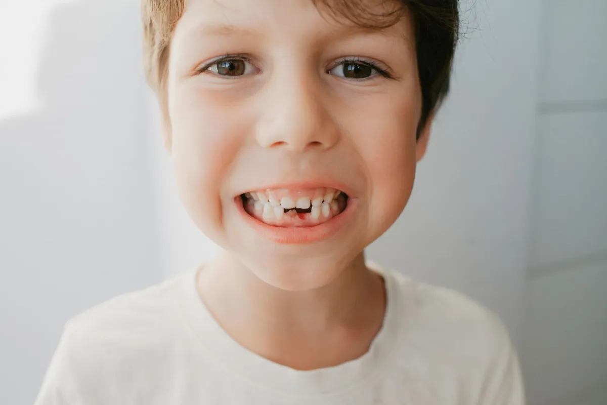 صورة أسنان الطفل