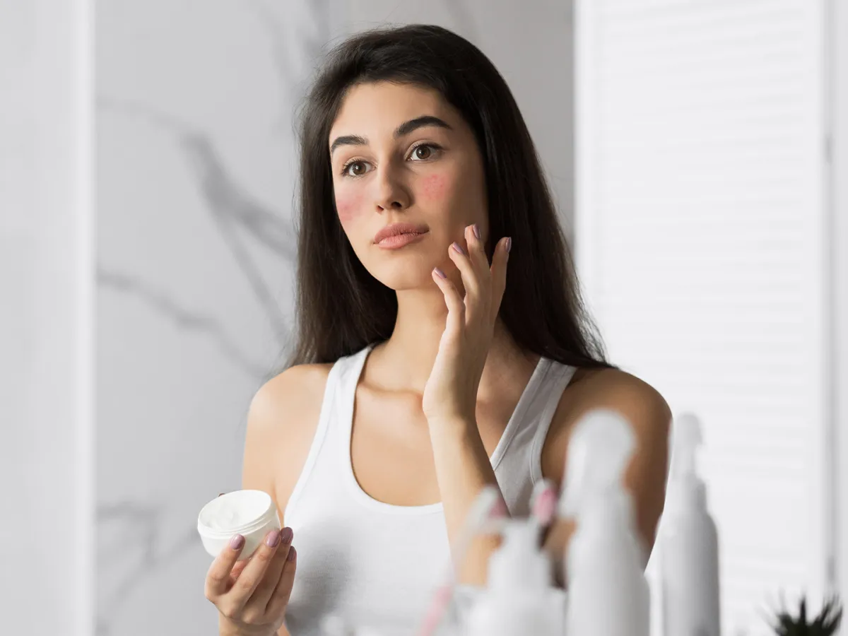 ما هو مرض الوردية؟ وما العلاجات المتاحة؟