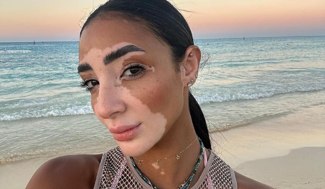 لوجينا صلاح ملكة جمال مصر تقدم رسالة إنسانية في منافسات ملكة جمال الكون ...