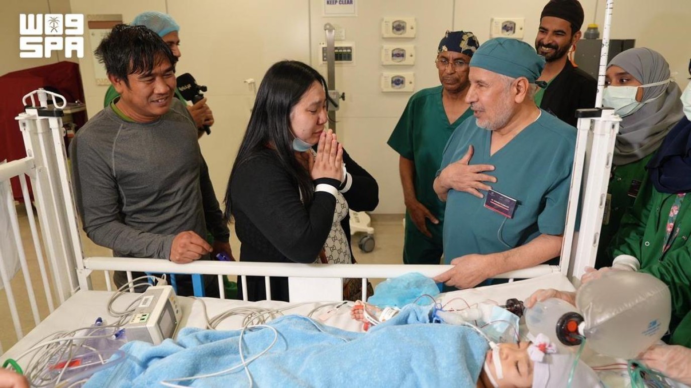 في إنجاز طبي جديد.. نجاح عملية فصل التوأم الملتصق الفلبيني (أوليفيا وجيانا) بعد 6 ساعات