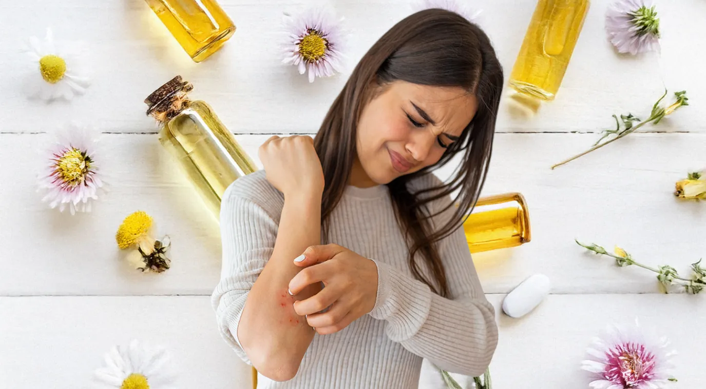 طرق تخفيف الأكزيما بمكوّنات منزلية