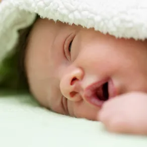 صورة تظهر وسادة رضاعة على الشفة العليا للرضيع