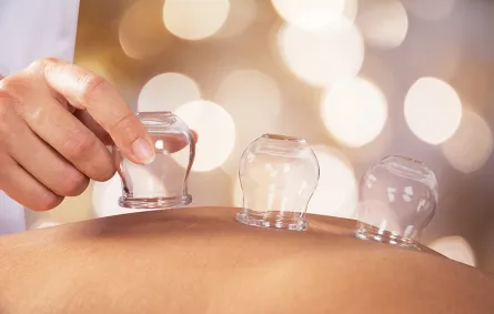 الحجامة: تعرّفي إلى فوائدها وطريقة عملها الصحيحة