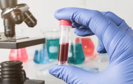 الحامل: اختبار للدم جديد يحدد تاريخ ولادة طفلك !