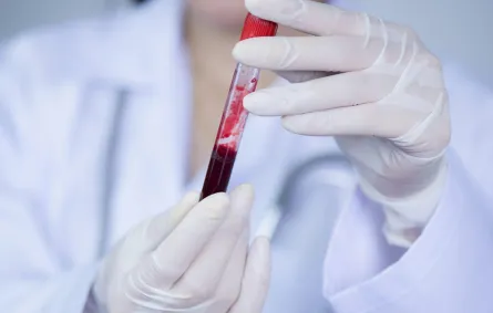 اكتشفي فصائل الدم وتأثيرها على الزواج