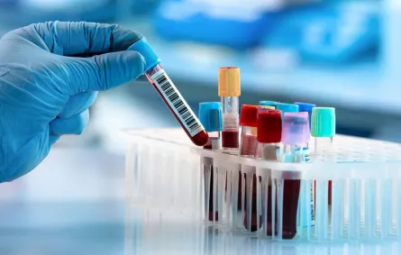 أخطر أنواع سرطان الدم.. تعرّفي إليها