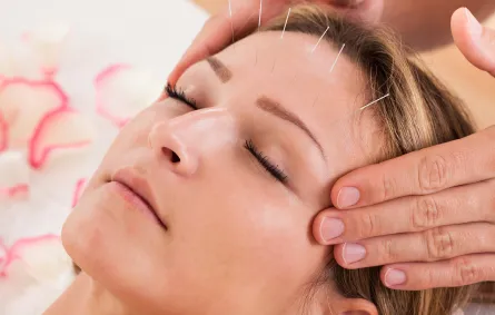 الوخز بالإبر الصينية أشهر علاجات تسكين الآلام