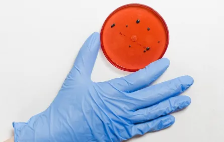 فحص للدم يشكف الإصابة بالزهايمر باكراً- المصدر: pexels-anna-shvets