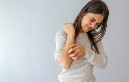 التوعية حول مرض الصدفية