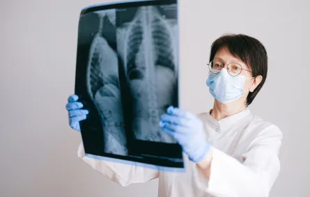 طبيبة تعاين صورة أشعة للصدر- المصدر: pexels-shvetsa
