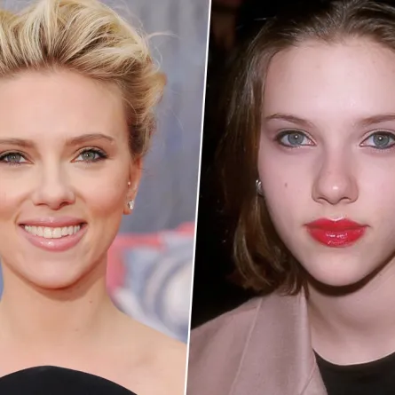 بالصور: 10نجمات قبل وبعد عمليات تجميل الأنف