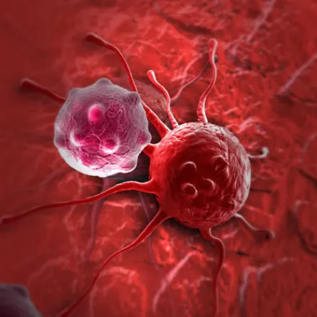 في اليوم العالمي للسرطان.. النساء أكثر إصابة من الرجال