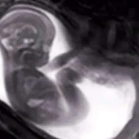 بالفيديو: هكذا يمضي جنينك الوقت في الرحم