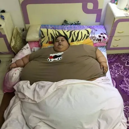 أثقل امرأة في العالم تخسر 100 كيلو بحمية غذائية