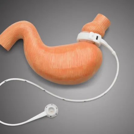 6600 عملية تكميم معدة لسعوديات في مستشفى أردني