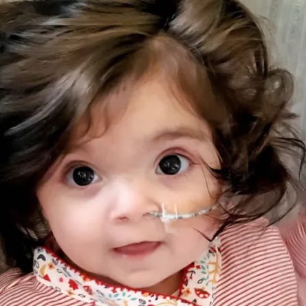 شبهوها بشخصية "بوو".. قصة طفلة شعرها حير كل من شاهدها