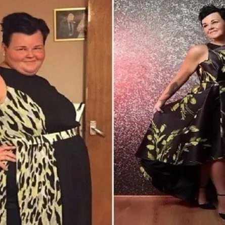 خسرت 90 كيلو من وزنها خلال 13 شهرًا لتصبح عارضة أزياء