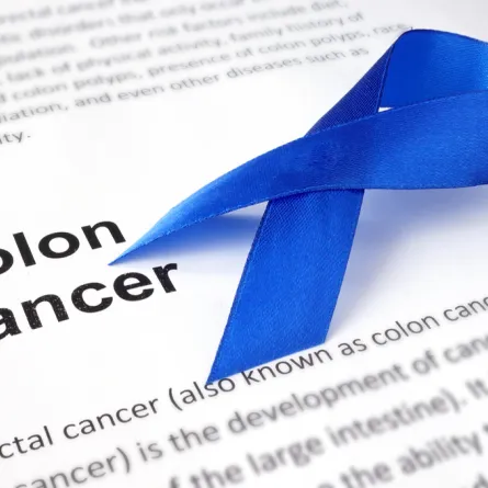 فحص جديد للكشف المبكر عن سرطان القولون والمستقيم