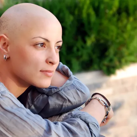 امرأة صلعاء تثير ضجّة: لماذا؟