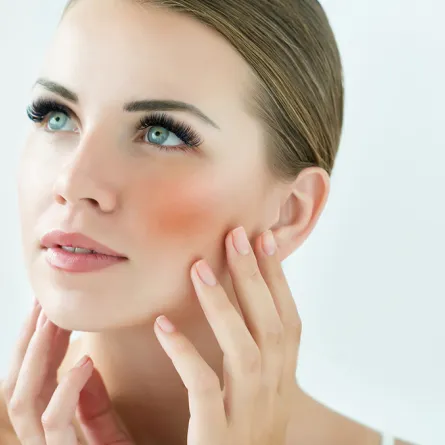 علاج الوردية الجلدية