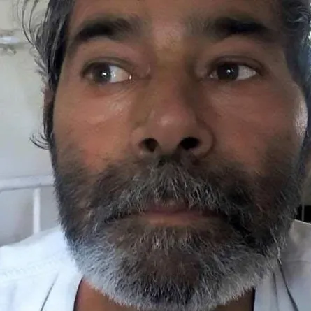 بالصور .. اكتشاف 75 مسماراً داخل جسد رجل بالصدفة!