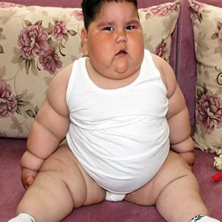 بالصور: طفل وزنه 32 كيلو جراماً وعمره 18 شهراً