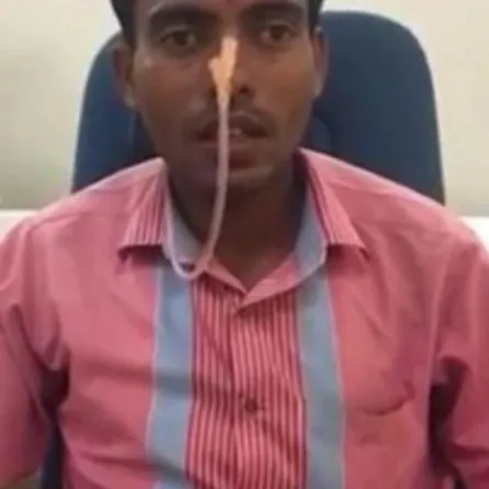 بالصور.. ماذا حدث مع صياد ابتلع سمكة «بلطي» حية؟