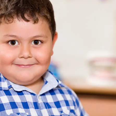 سرطان القولون: زيادة الوزن في الطفولة يرفع خطر الإصابة