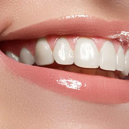 تبييض الاسنان المنزلي بـ 3 خلطات طبيعية مجربة