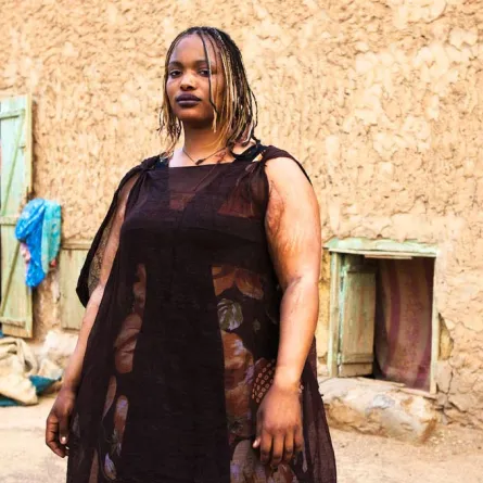 أغرب معايير الجمال منذ القِدم وحتى الآن!