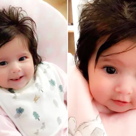 بالفيديو.. شعرها ظهر في فحص الـ "إيكو" وهي جنين