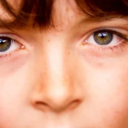 39% من أسباب إصابات عيون الأطفال أثناء اللعب