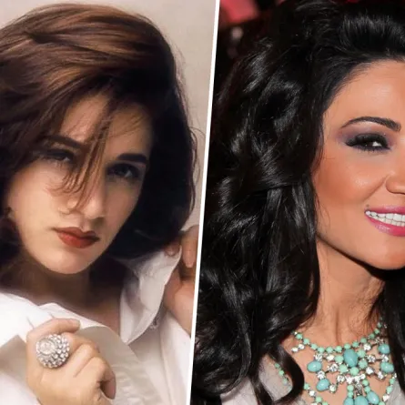 نجمات قبل وبعد عمليات التجميل 