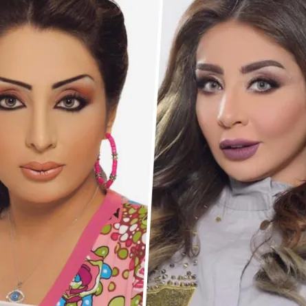 نجمات الخليج قبل وبعد عملية رفع الحواجب