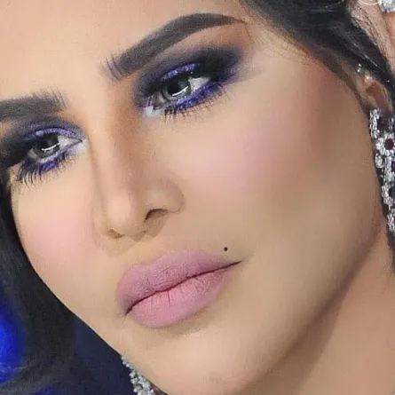 بالفيديو: أحلام  تشرح تفاصيل عملياتها التجميلية الجديدة